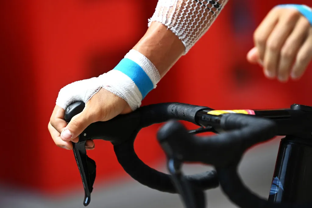 ALTO DE LA MONTAÑA DE CULLERA, SPAIN - AUGUST 19: Detail view of a bandaged hand prior to the 76th Tour of Spain 2021, Stage 6 a 158,3km stage from Requena to Alto de la Montaña de Cullera 184m / @lavuelta / #LaVuelta21 / on August 19, 2021 in Alto de la Montaña de Cullera, Spain. (Photo by Stuart Franklin/Getty Images)