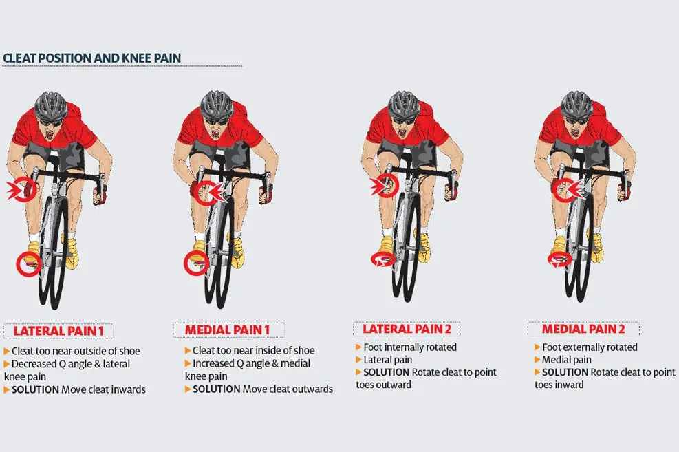 Diagram showing how cleat position can cause cycling knee pain. There are illustrations showing types of lateral pain and medial pain.