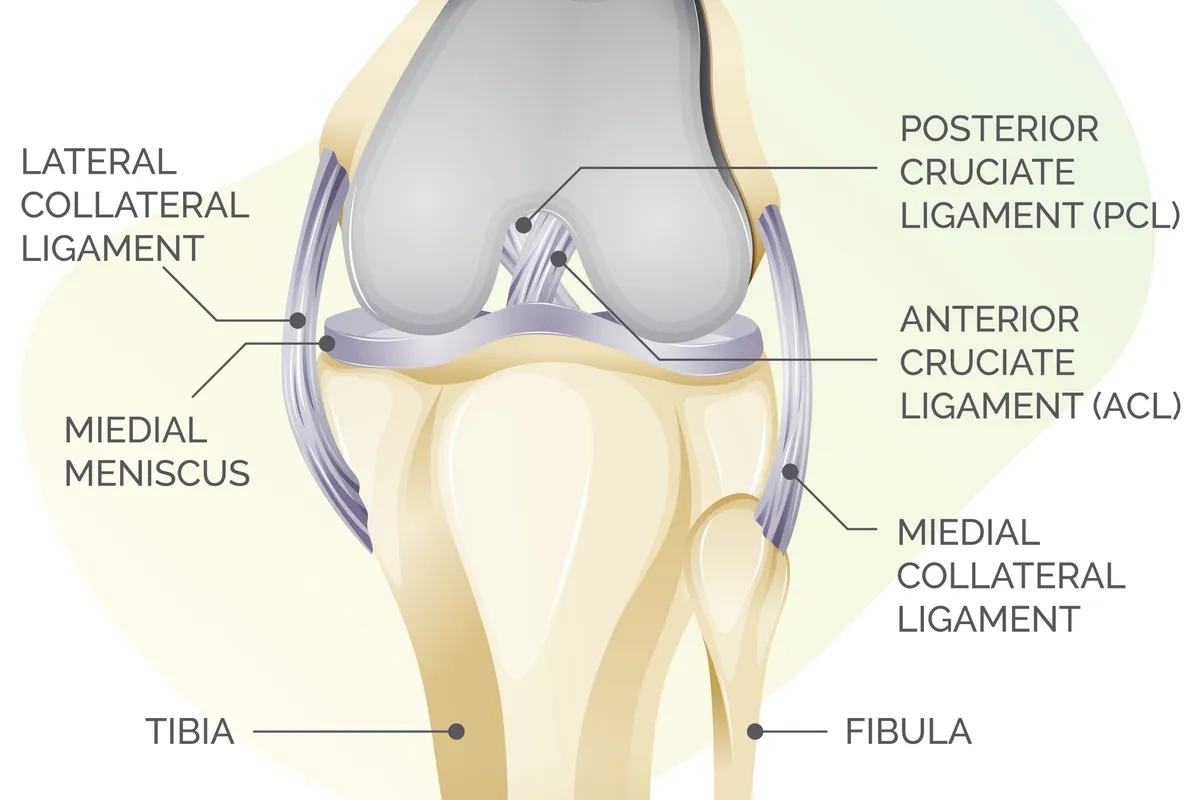 iagram showing knee joint and ligaments. The diagram is labelled clockwise: Laterala collateral ligament; posterior cruciate ligament (PCL); Anterior Cruciate Ligament (ACL); Medial Collateral Ligament; Fibula; Tibia: Medial Meniscus. 