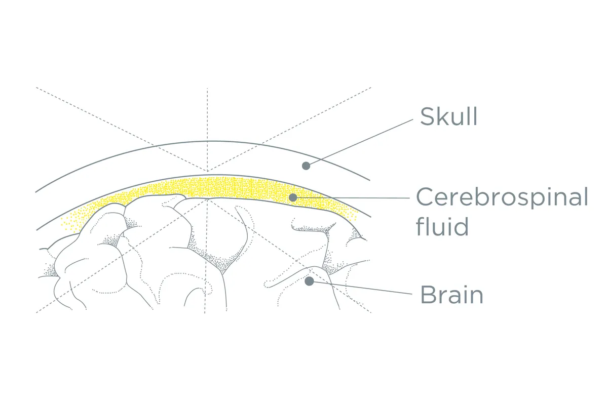 Diagram showing a cross section of the head with different parts labelled. The outer layer is labelled 'skull', the middle yellow layer is labelled 'cerebrospinal fluid', and the central section is labelled 'brain'
