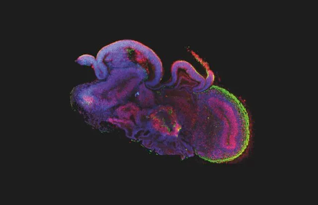 One of Madeline Lancaster’s cerebral organoids, seen here in cross-section © MRC-LMB