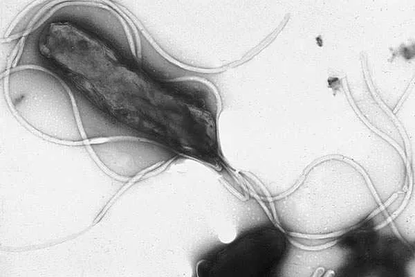 Helicobacter pylori by Yutaka Tsutsumi, M.D.Professor Department of PathologyFujita Health University School of Medicine (Copyrighted free use), via Wikimedia Commons