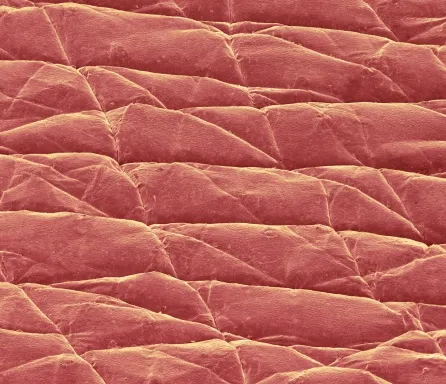 Coloured scanning electron micrograph (SEM) of the surface of the skin (red) of a 43-year-old © Science Photo Library/Getty Images