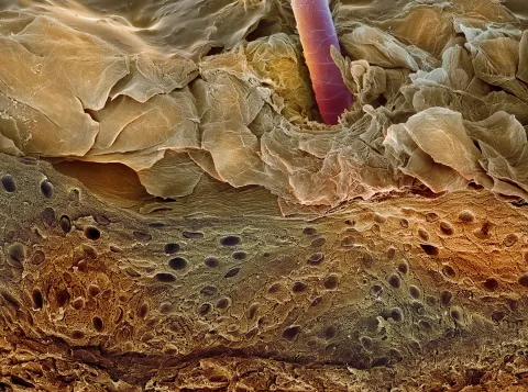 Coloured scanning electron micrograph (SEM) of a section through human skin. The living layer of the epidermis (dark brown) is called the Malpighian layer, which contains cells called melanocytes © Science Photo Library/Getty Images