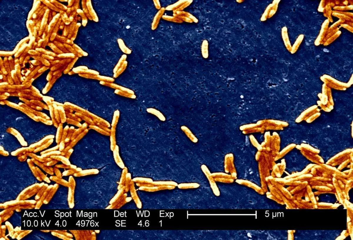 Campylobacter spp. © BSIP/UIG Via Getty Images