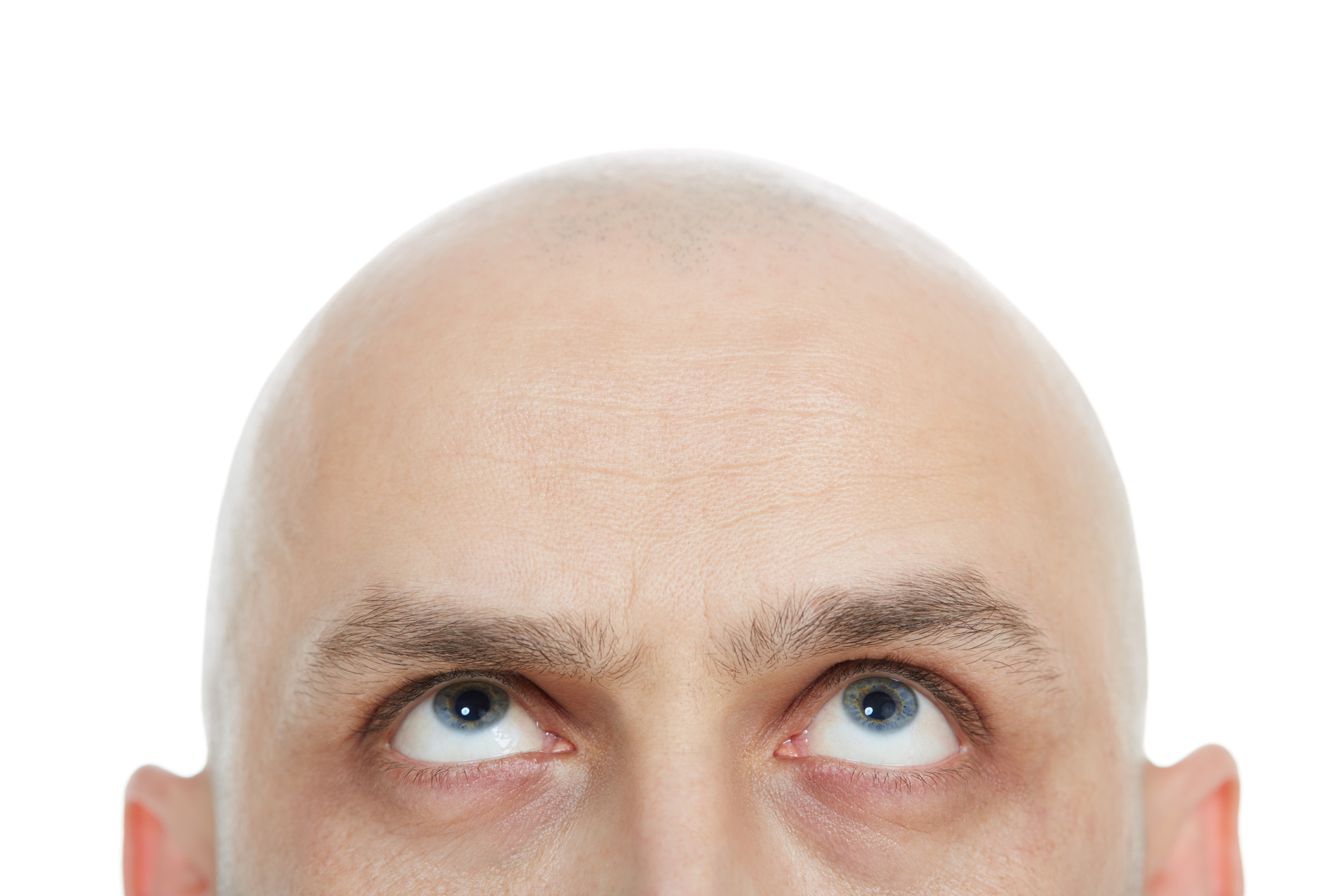 Why do men Focus bald Magazine the - BBC Science of heads? top go from their
