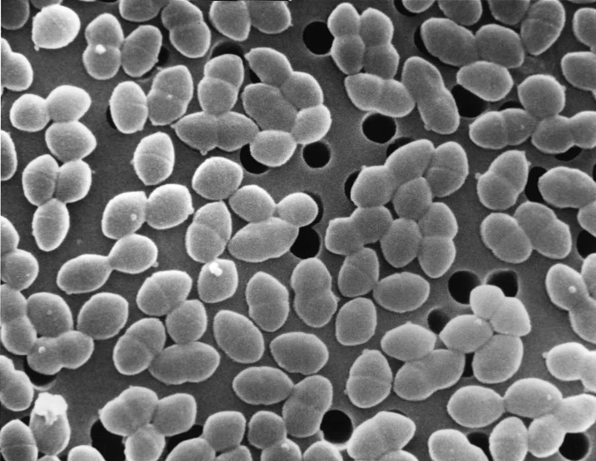 Enterococcus faecium © BSIP/UIG Via Getty Images
