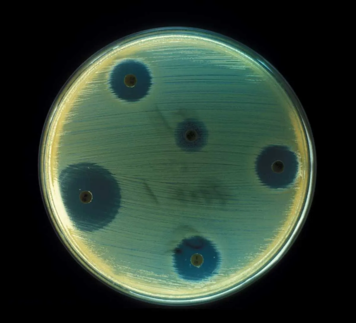 Staphylococcus Aureus (MRSA) © Smith Collection/Gado/Getty Images