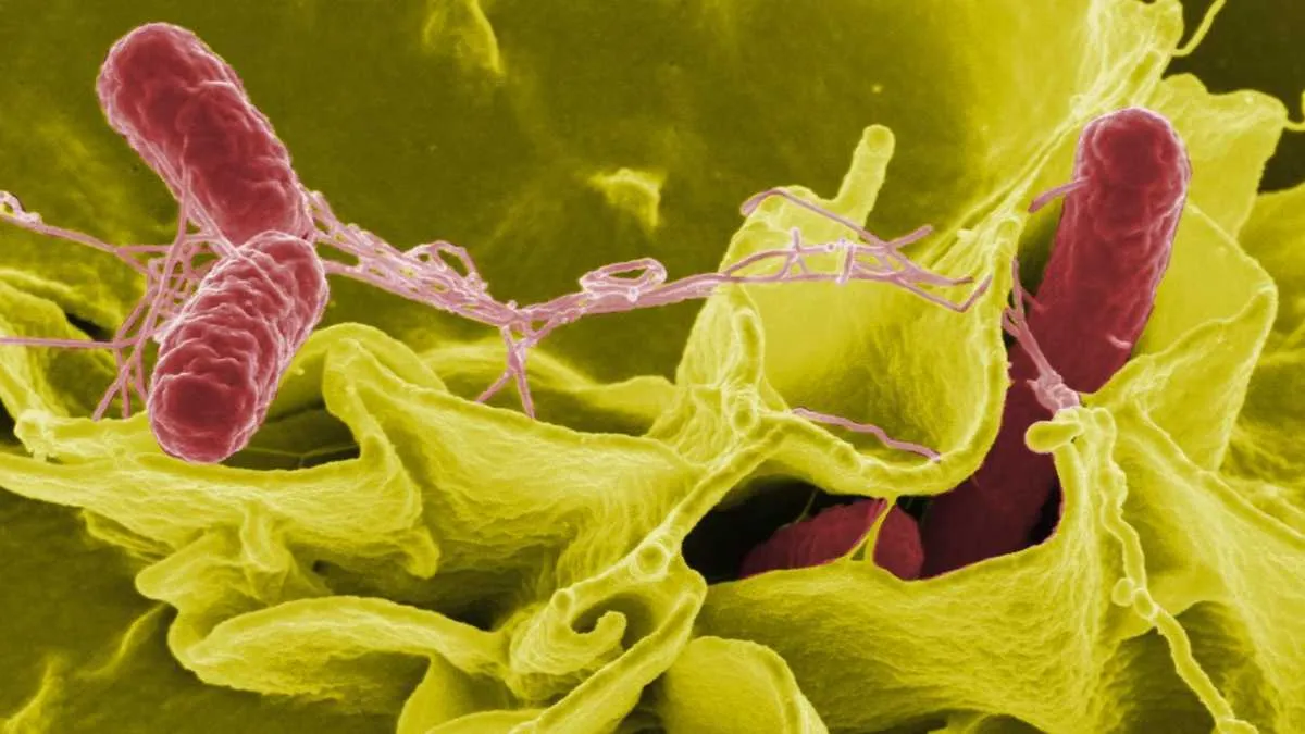 Salmonella © National Institute of Allergy and Infectious Diseases (NIAID)