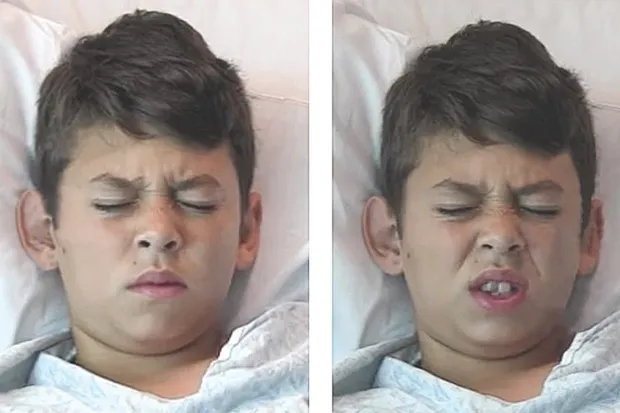 In the picture on the left the boy is suffering ongoing pain, on the right he is suffering transient pain – the difference in his facial expression is clearly visible (© UC San Diego School Of Medicine)