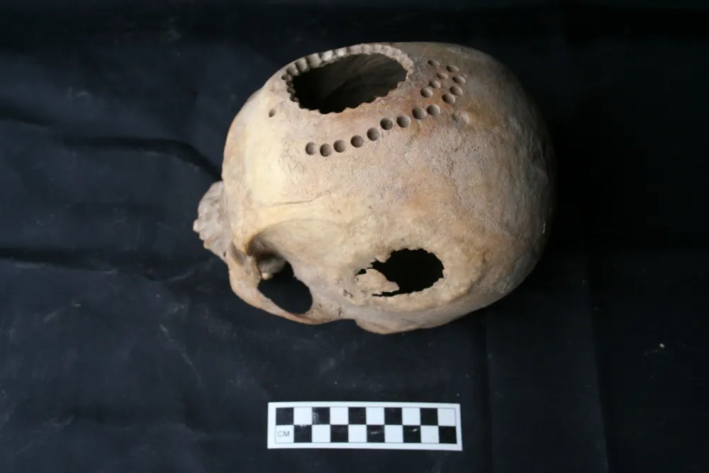 Trepanned skull found in Peru © Danielle Kurin/University of California - Santa Barbara