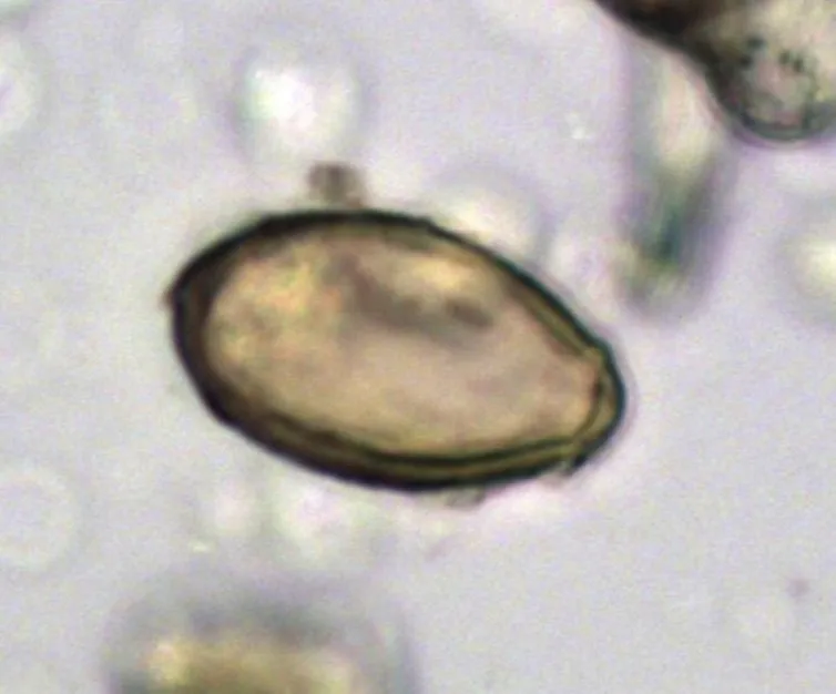 Egg of Chinese liver fluke discovered in the latrine at Xuanquanzhi, viewed using microscopy. Dimensions 29 x 16 micrometers. The Journal of Archaeological Science: Reports., CC BY-SA