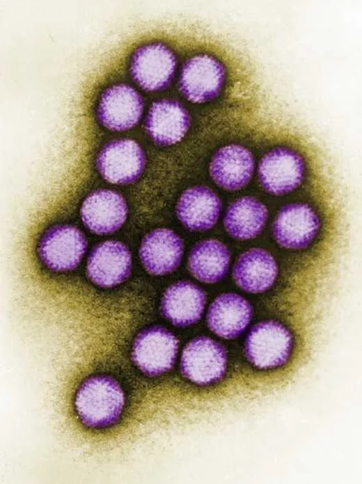 Human-adenovirus-10010