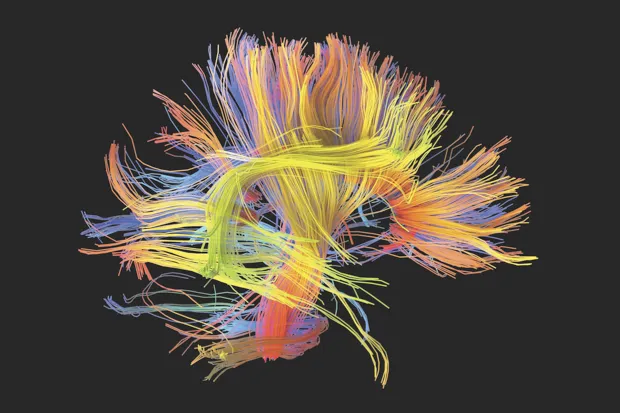 White matter fibres, as seen in this 3D scan, coordinate the flow of information between different areas of the brain. Flaws in white matter have been linked to psychopathic traits © Getty Images