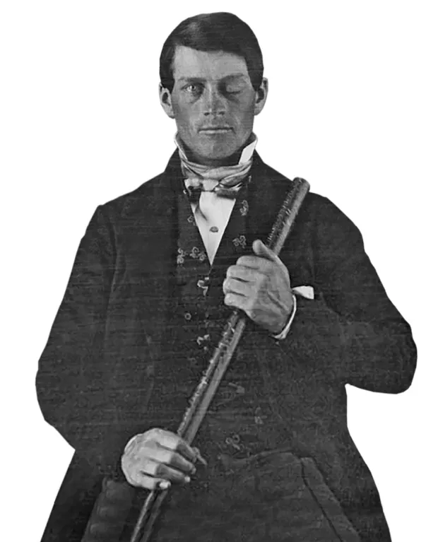 Phineas Gage survived after an iron rod (held by Gage in this image) was blasted through his brain © Originally from the collection of Jack and Beverly Wilgus, and now in the Warren Anatomical Museum, Harvard Medical School. (Attribution, GFDL or CC BY-SA 3.0)