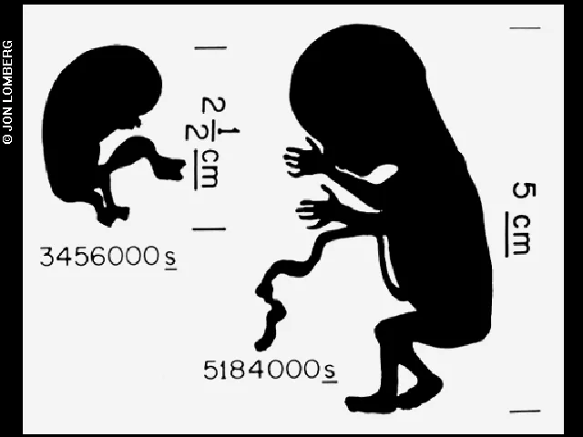 Fetus diagram © Jon Lomberg