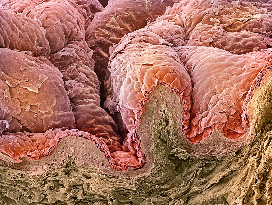 The outer layer of the skin, the epidermis, is formed from overlapping layers of skin cells © Getty Images