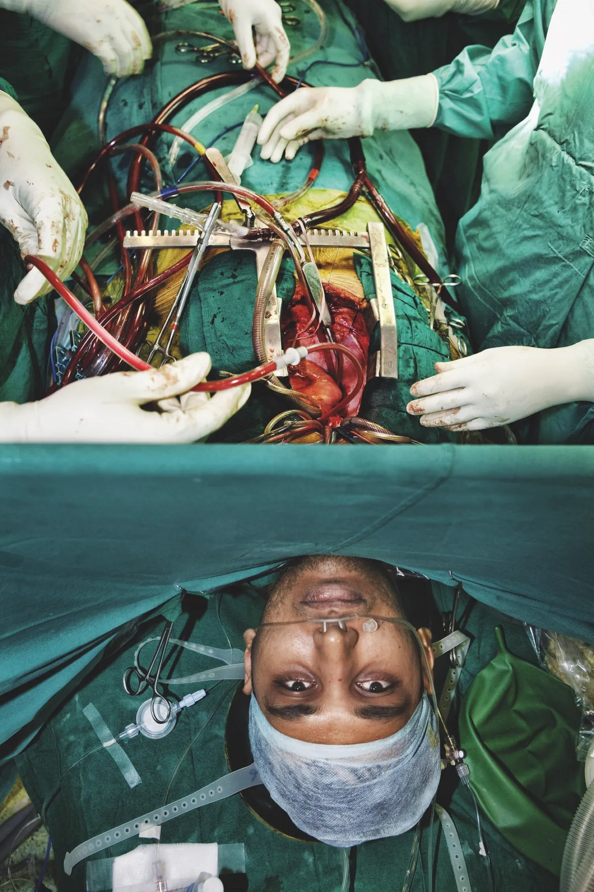 Awake Heart Surgery © Tom Parker