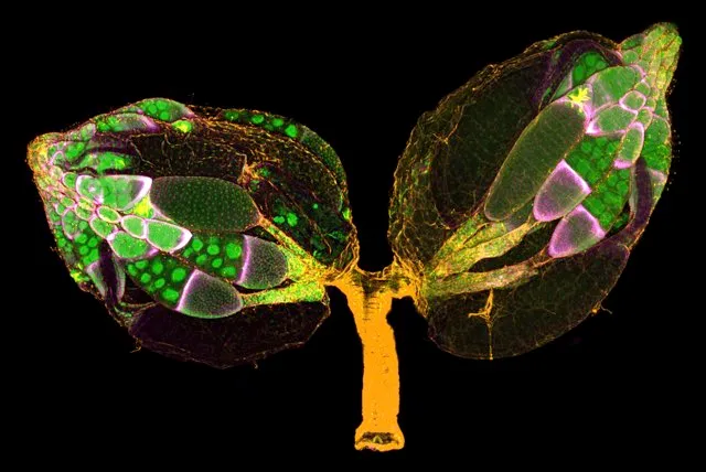 A pair of ovaries from an adult Drosophila female stained for F-actin (yellow) and nuclei (green); follicle cells are marked by GFP (magenta) © Dr. Yujun Chen & Dr. Jocelyn McDonald
