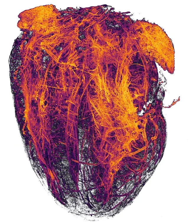 Blood vessels of a murine (mouse) heart following myocardial infarction (heart attack) © Simon Merz, Lea Bornemann & Sebastian Korste