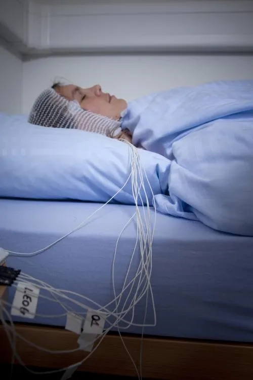 A patient with a high-density electroencephalogram (EEG), which measures brain activity during sleep using numerous electrodes placed on the skull © Baumann, Dorothée