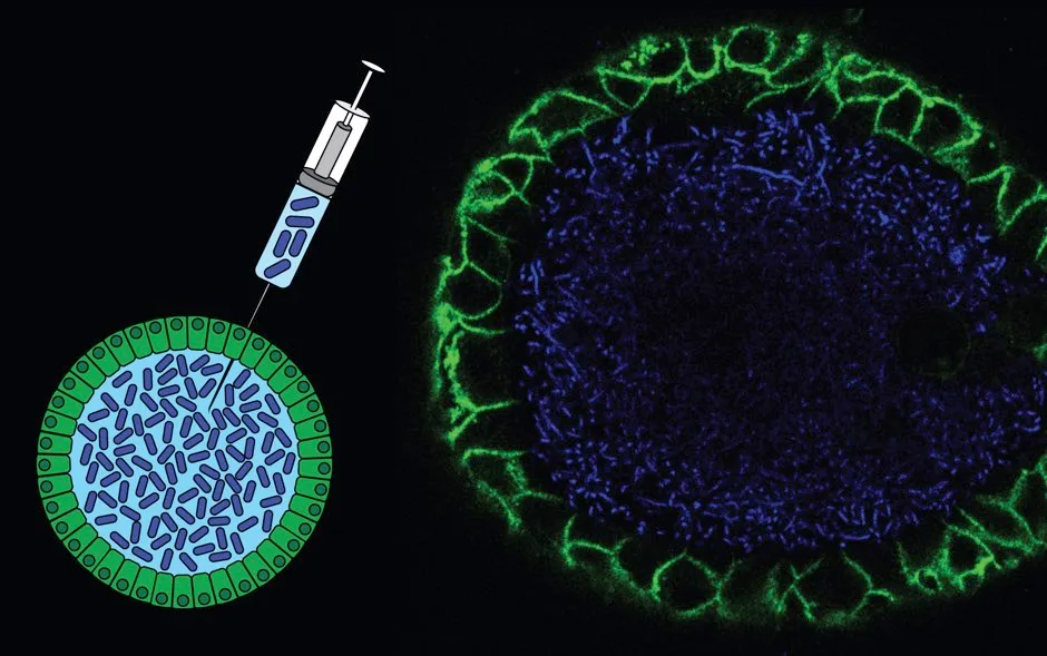 Representation of the injection of bacteria into the lab-grown gut replica and a fluorescent microscopy image of such an organoid (Cayetano Pleguezuelos-Manzano, Jens Puschhof, Axel Rosendahl Huber © Hubrecht Institute)