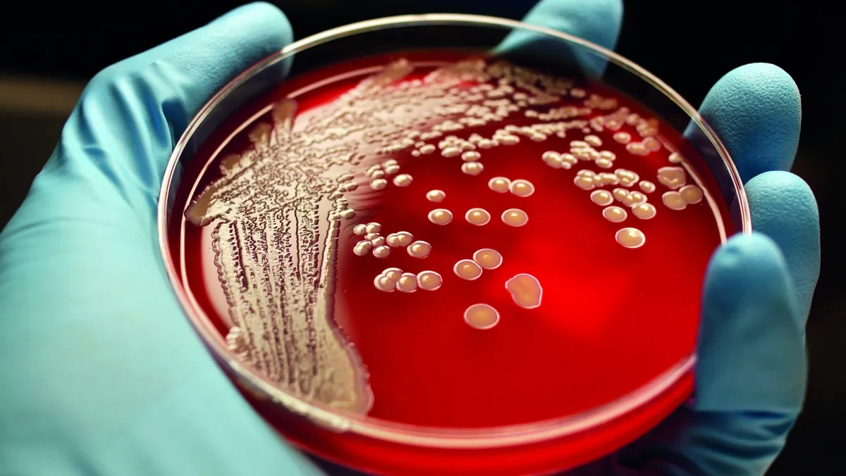 MRSA colonies grown on an agar plate in a lab