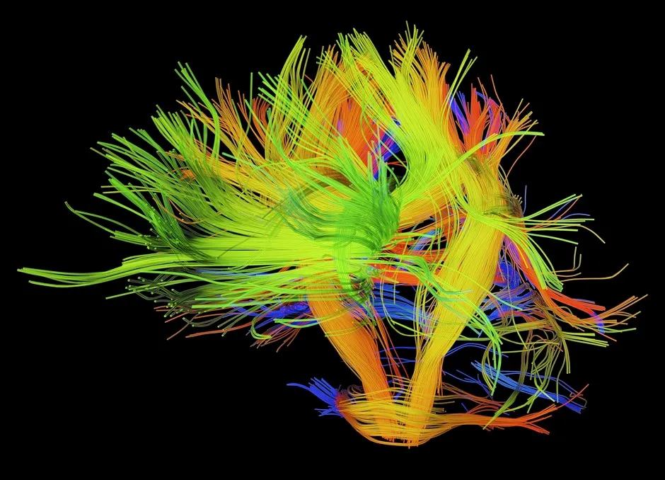 White matter fibres of the human brain © Getty Images