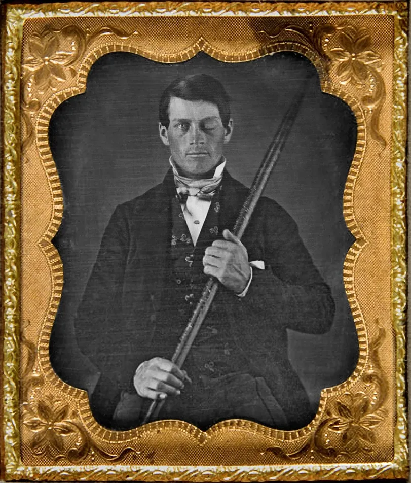Phineas Gage (Originally from the collection of Jack and Beverly Wilgus, and now in the Warren Anatomical Museum, Harvard Medical School/CC BY-SA)