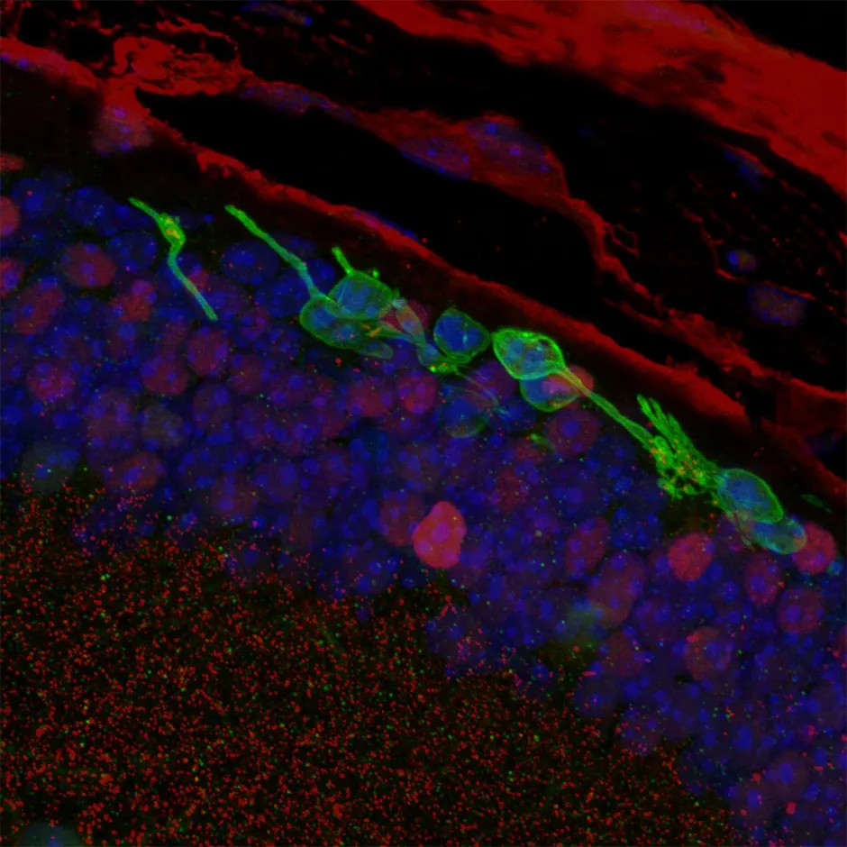 The photoreceptor cells, shown in green, three months after transplantation © Sai Chavala
