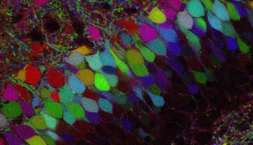 Coloured neurons in the hippocampus of a mouse © AFP via Getty Images