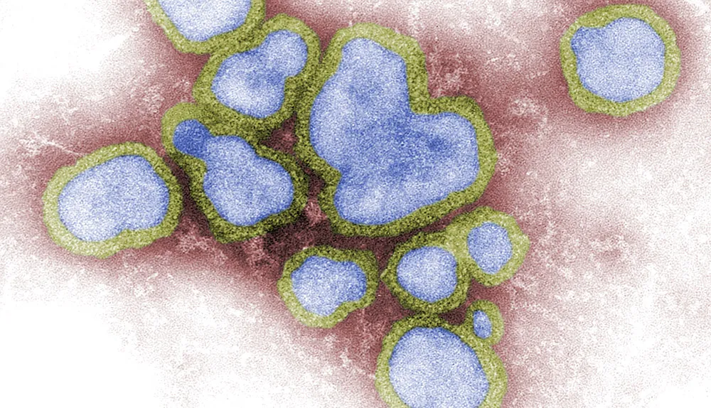 Influenza A Virus © Getty Images