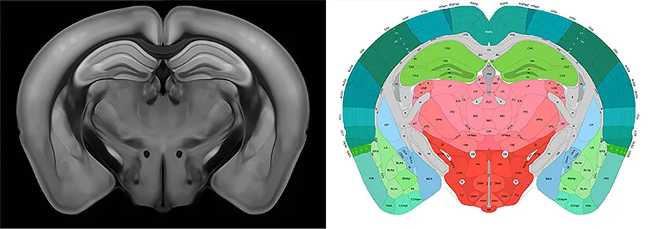 A virtual section of the 3D mouse brain atlas © Allen Institute for Brain Science