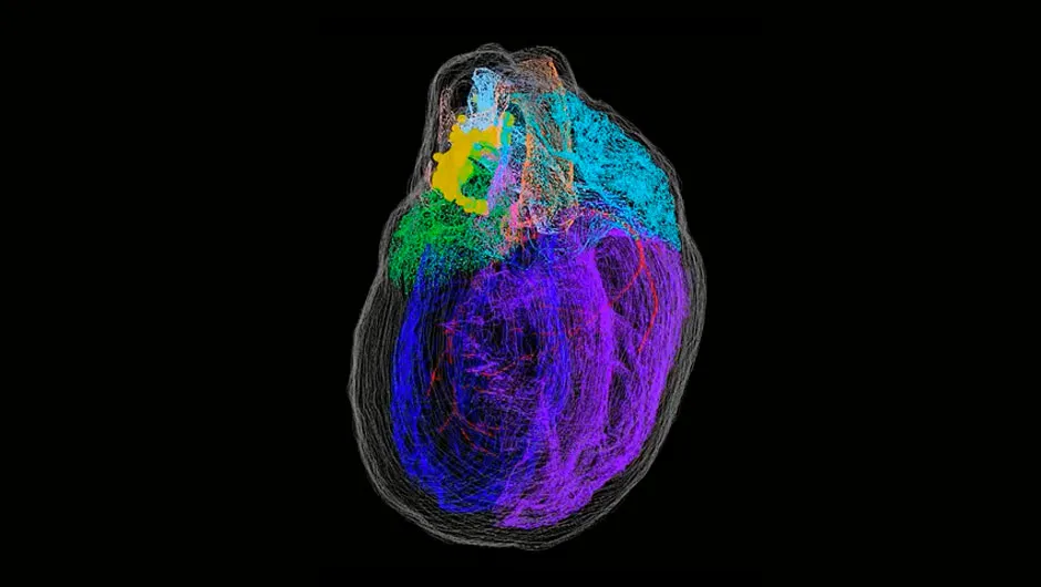 This image shows a whole-heart view of the 3D reconstructed male rat heart, showing the extent and distribution of the intrinsic cardiac neurons © Achanta et al. - iScience