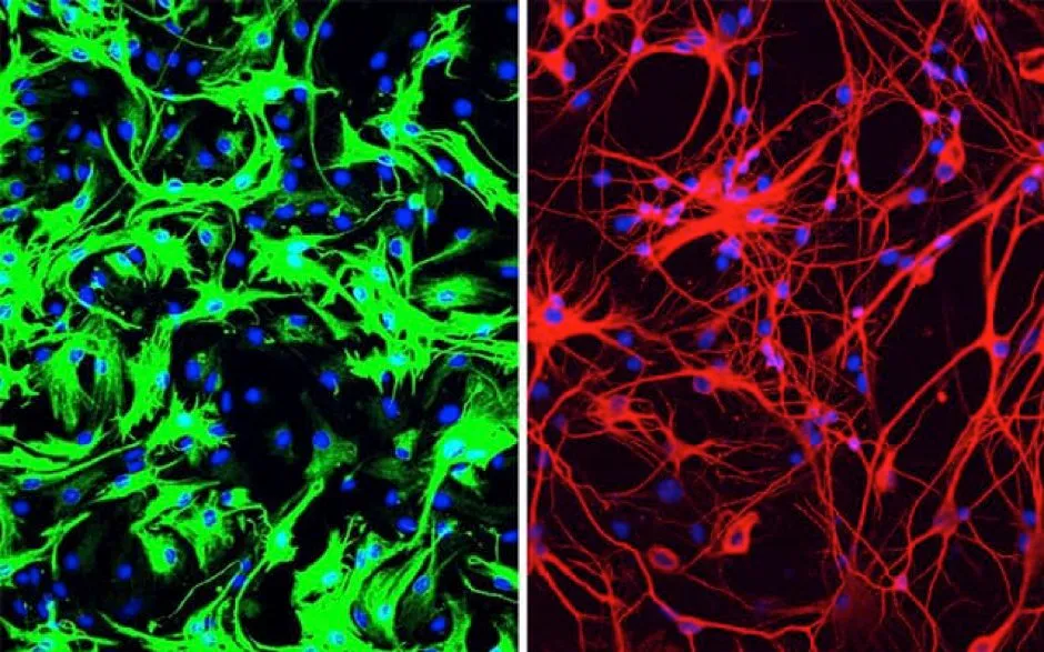 Left: mouse astrocytes (green) before reprogramming; Right: neurons (red) induced from mouse astrocytes after reprogramming © UC San Diego Health Sciences
