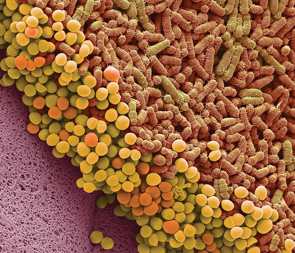 Scanning electron microscope image of bacteria cultured from human faeces © Getty Images