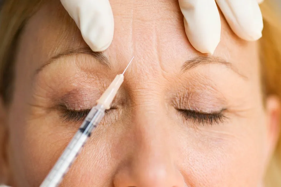 Botox injection © Getty Images