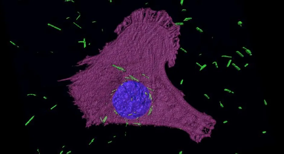 Gold nanotubes, shown here in green, inside mesothelioma cancer cells © Arsalan Azad