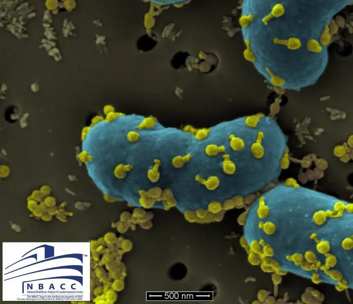 SEM Image of Tom’s superbug, Acinetobacter baumannii,and the phages used to target and destroy it © NBACC