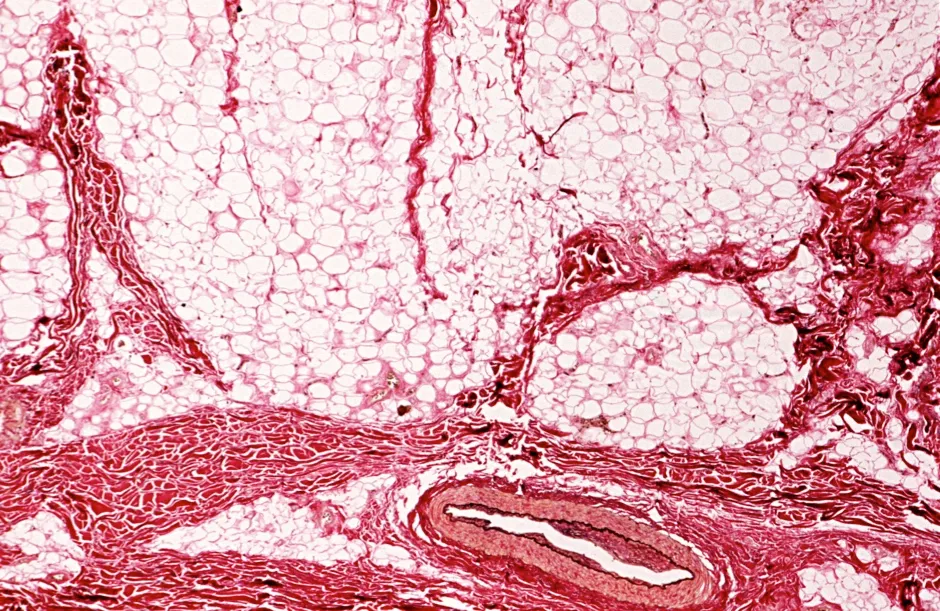 Microscope image of human skin cells