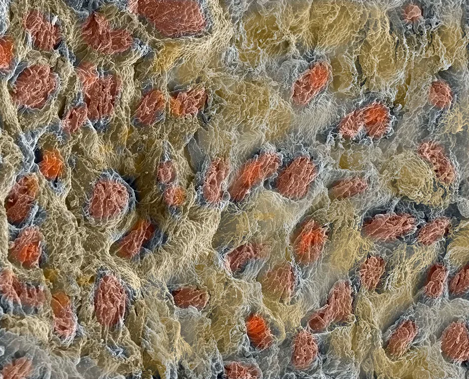 Surface of the human tongue photographed under microscope, showing the papillae
