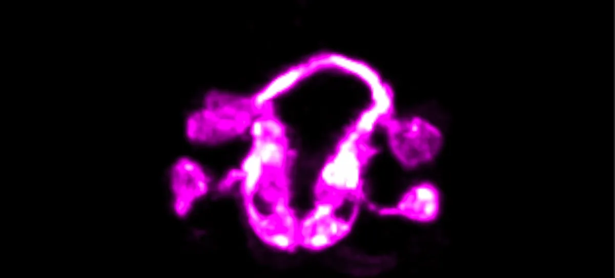 The team devised an imaging technique that allows them to see the brain develop in the nematode C. elegans © Yale University