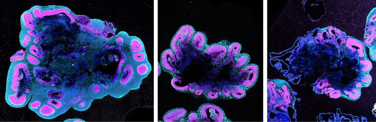 Human brain organoids grow substantially bigger than gorilla and chimpanzee (left to right). These brain organoids are 5 weeks old. © S.Benito-Kwiecinski/MRC LMB/Cell