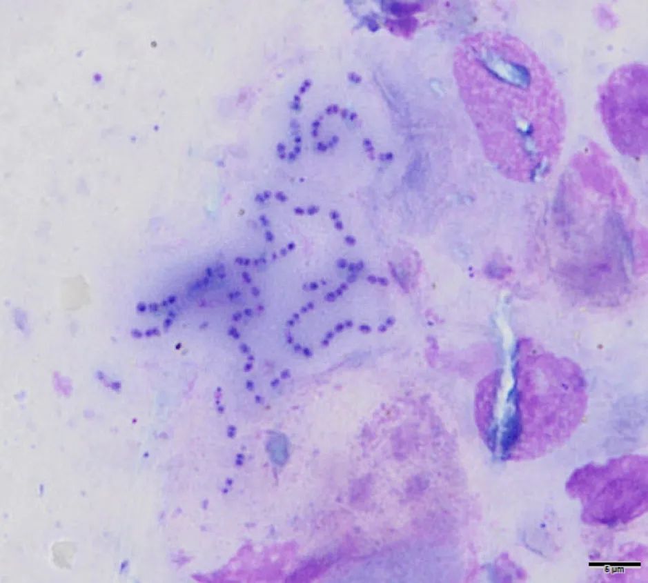 Microscopic image showing the Enterococcus lacertideformus bacterium (dark purple circles) surrounded by a thick biofilm (light purple haze)