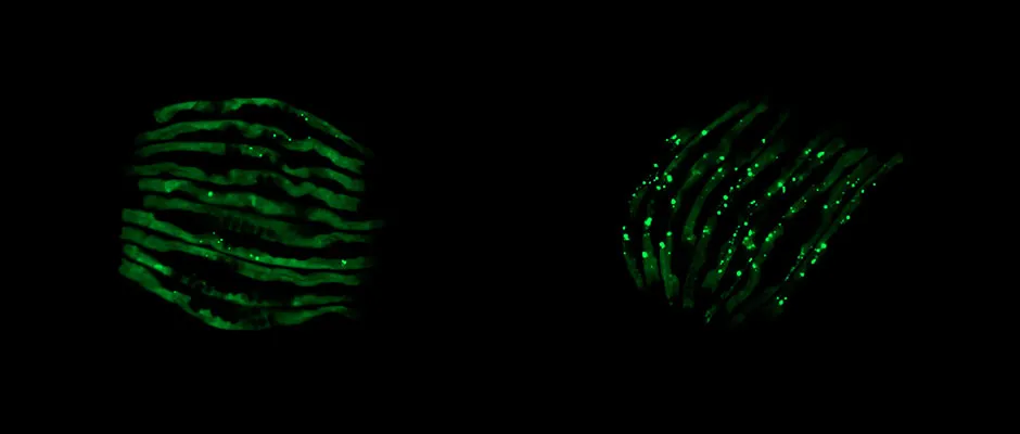 Normal C. elegans (left) compared with worms infected with pathogenic bacteria © University of Florida