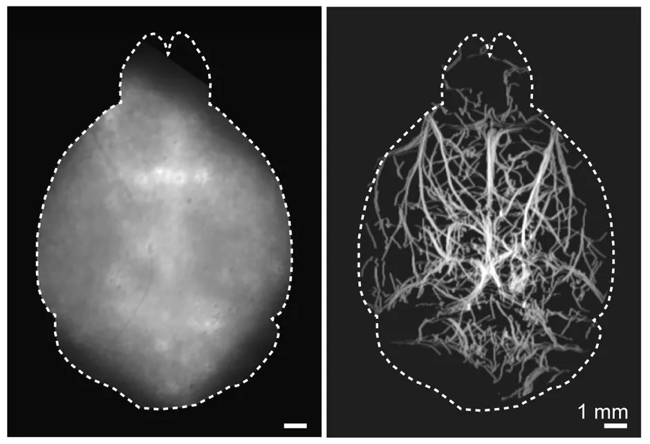 A conventional widefield fluorescence image of the mouse brain taken non-invasively in the visible light spectrum is shown on the left, while the non-invasive localization-based DOLI approach operating in the NIR-II spectral window is shown on the right. © Daniel Razansky, University and ETH Zurich