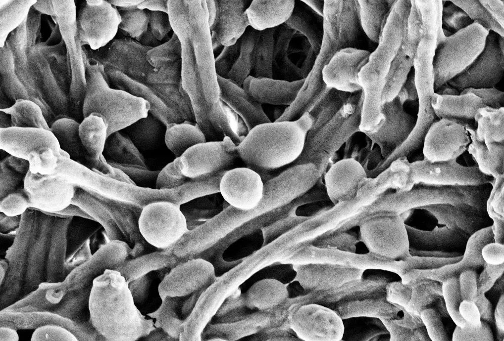 The fungus Candida albicans, a type of yeast, lives in the gut microbiota and plays a role in health and gastrointestinal disease. The scanning electron micrograph shows the yeast in its pathogenic, hyphal form.