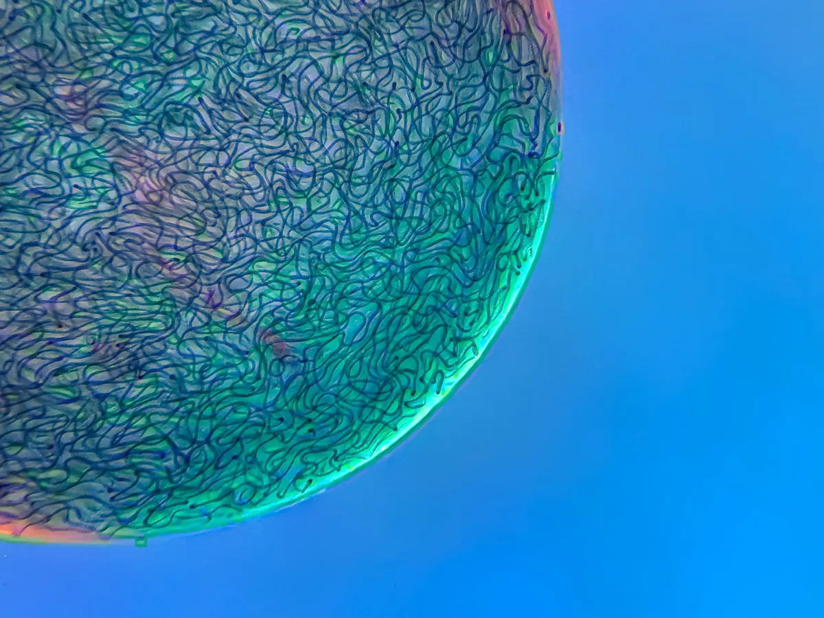 Filamentous strands of Nostoc cyanobacteria captured inside a gelatinous matrix. Photo by
