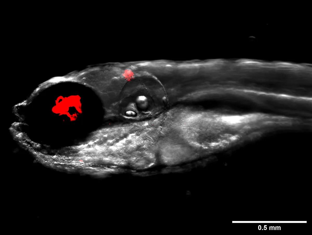 Zebrafish infected with fluorescent bacteria, Mycobacterium abscessus, shown in red © Dr Matt Johansen and the Kremer Lab