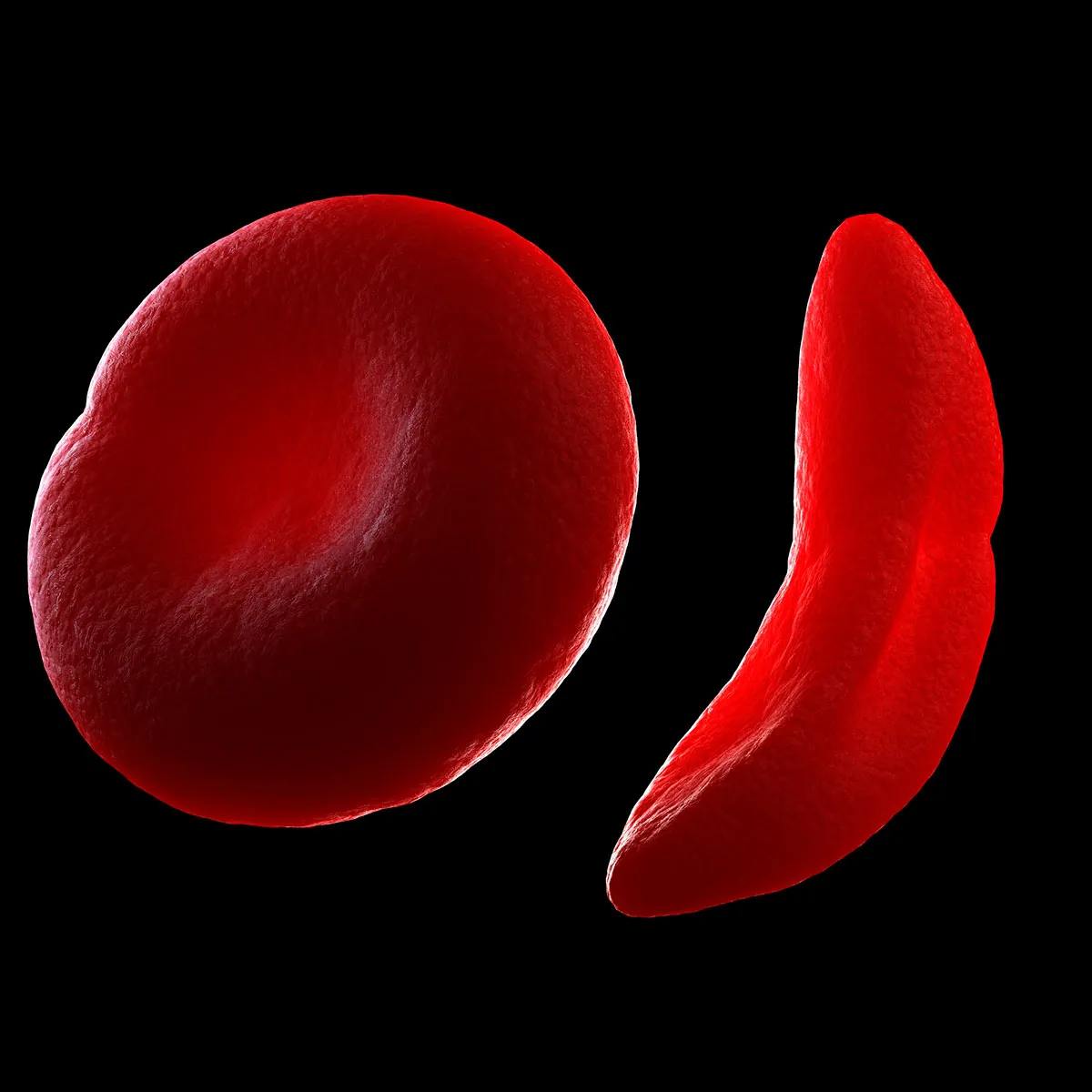 A healthy blood cell and a sickle-shaped blood cell © Getty Images